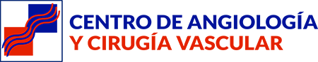 Centro de Angiología Vascular